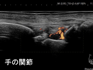 整形超音波検査